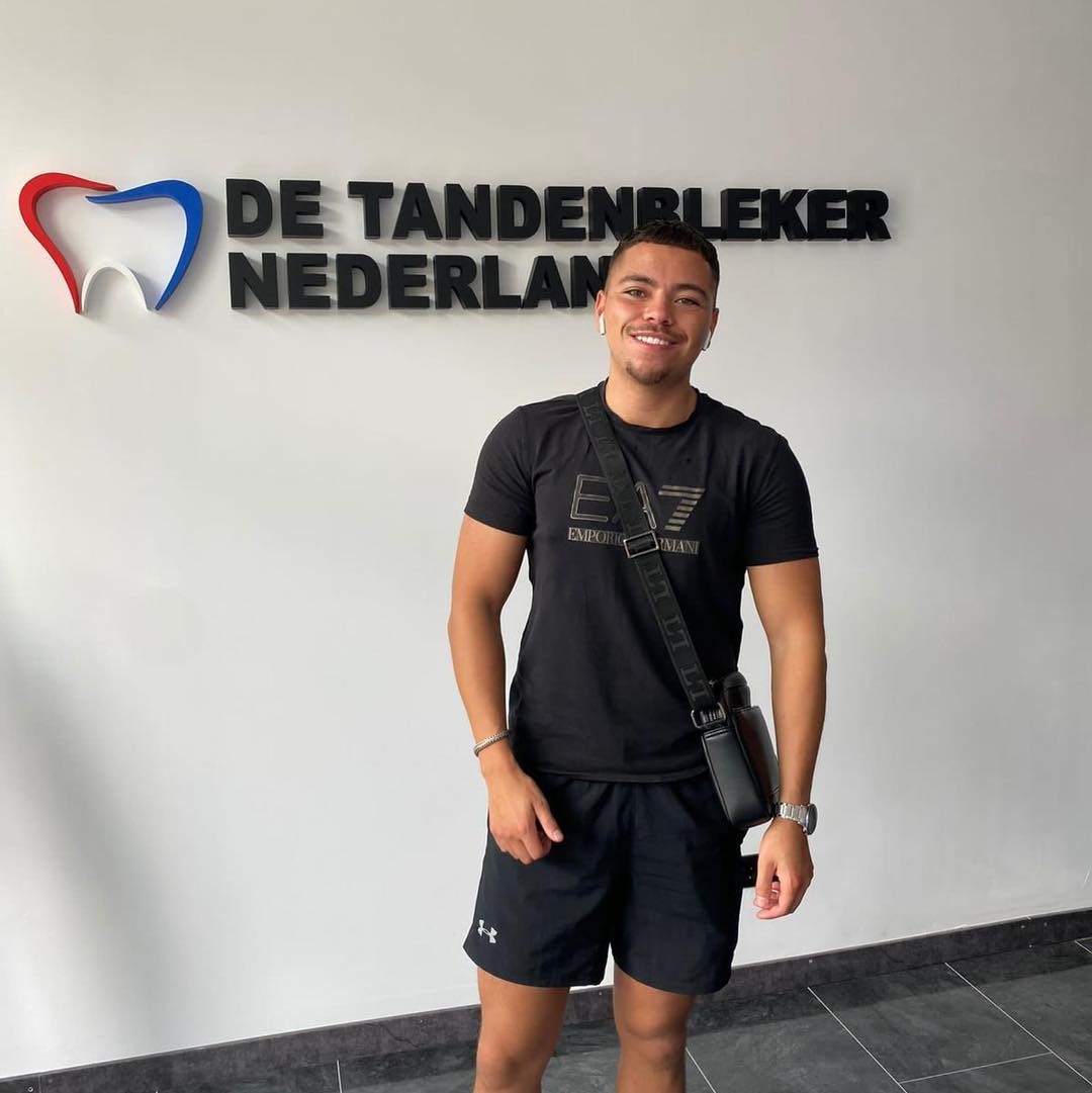 Resultaat 19 — glimlach na bleekbehandeling bij De Tandenbleker Nederland
