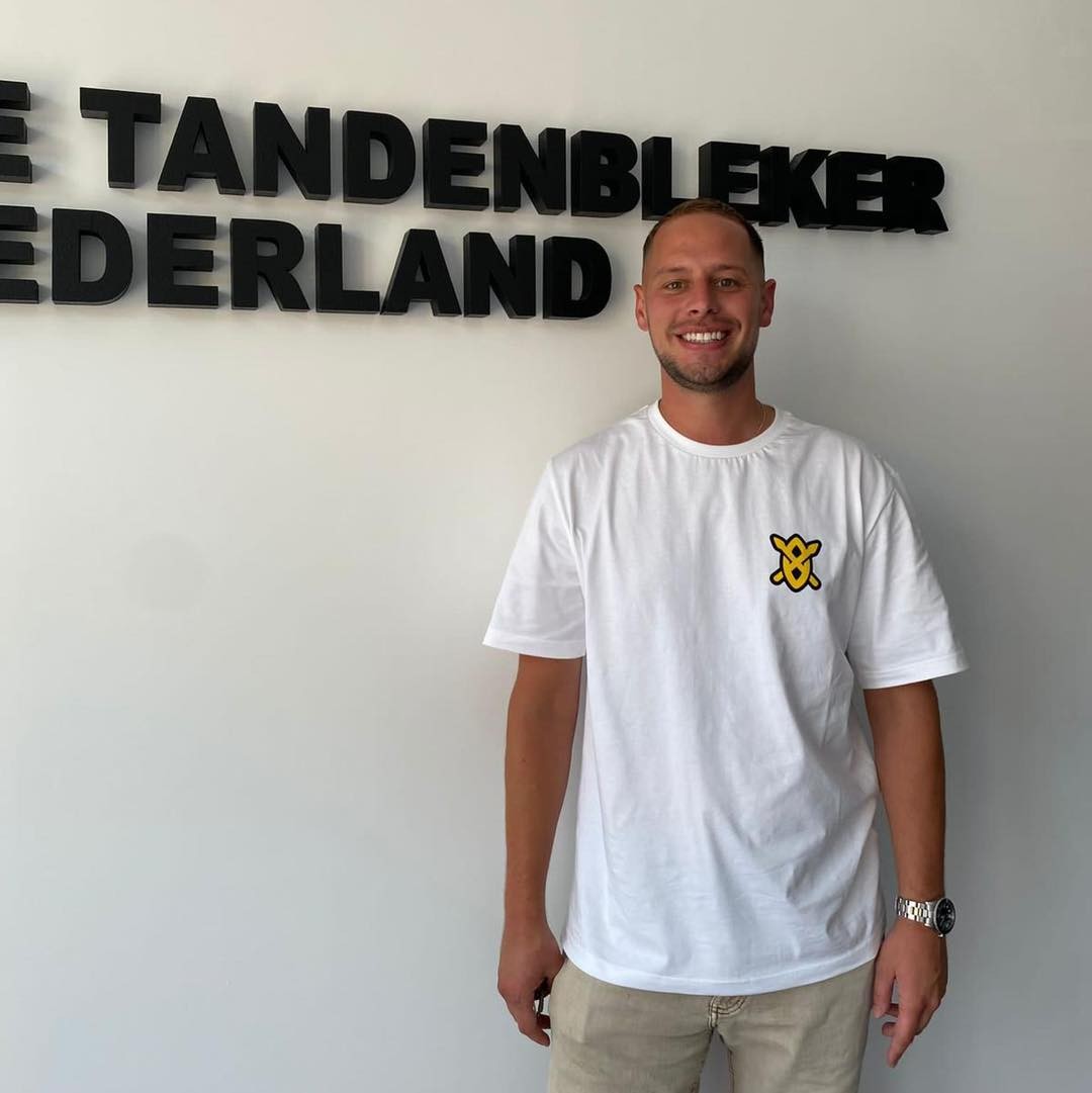 Resultaat 23 — glimlach na bleekbehandeling bij De Tandenbleker Nederland