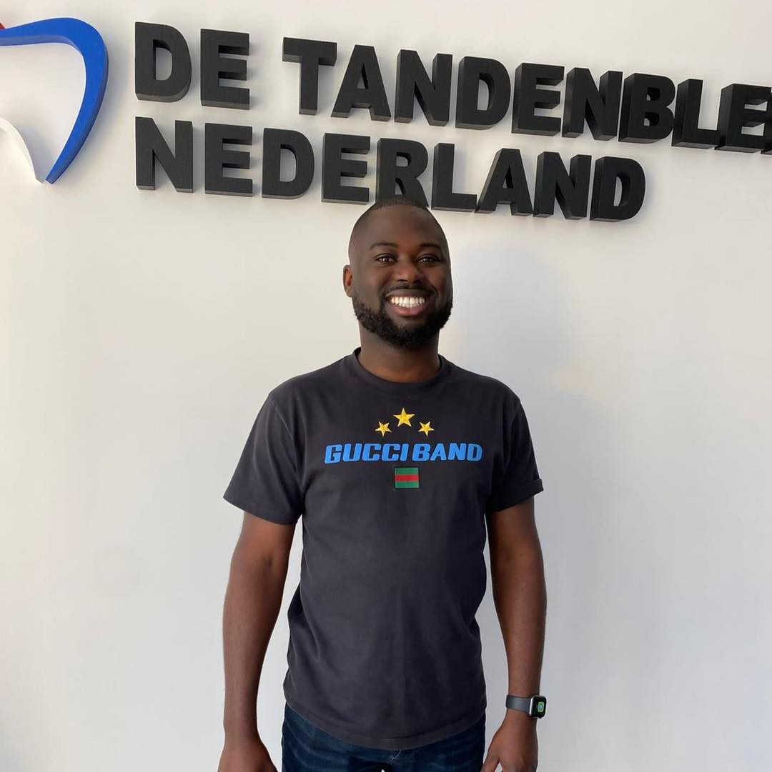Resultaat 16 — glimlach na bleekbehandeling bij De Tandenbleker Nederland