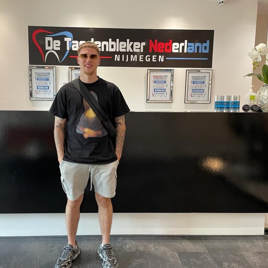 Resultaat 12 — glimlach na bleekbehandeling bij De Tandenbleker Nederland