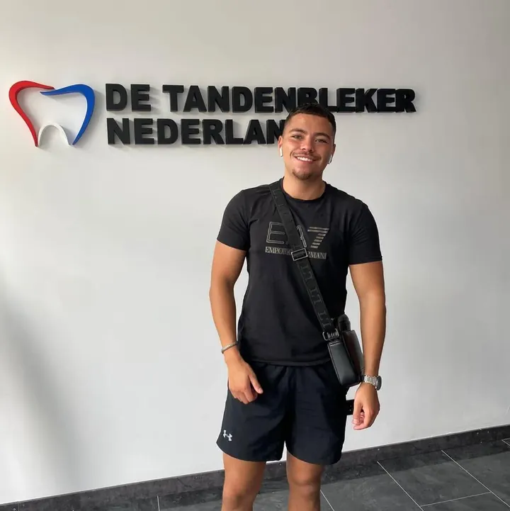 Resultaat 19 — glimlach na bleekbehandeling bij De Tandenbleker Nederland
