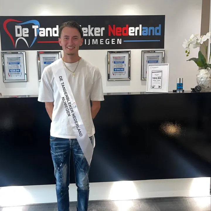 Resultaat 15 — glimlach na bleekbehandeling bij De Tandenbleker Nederland