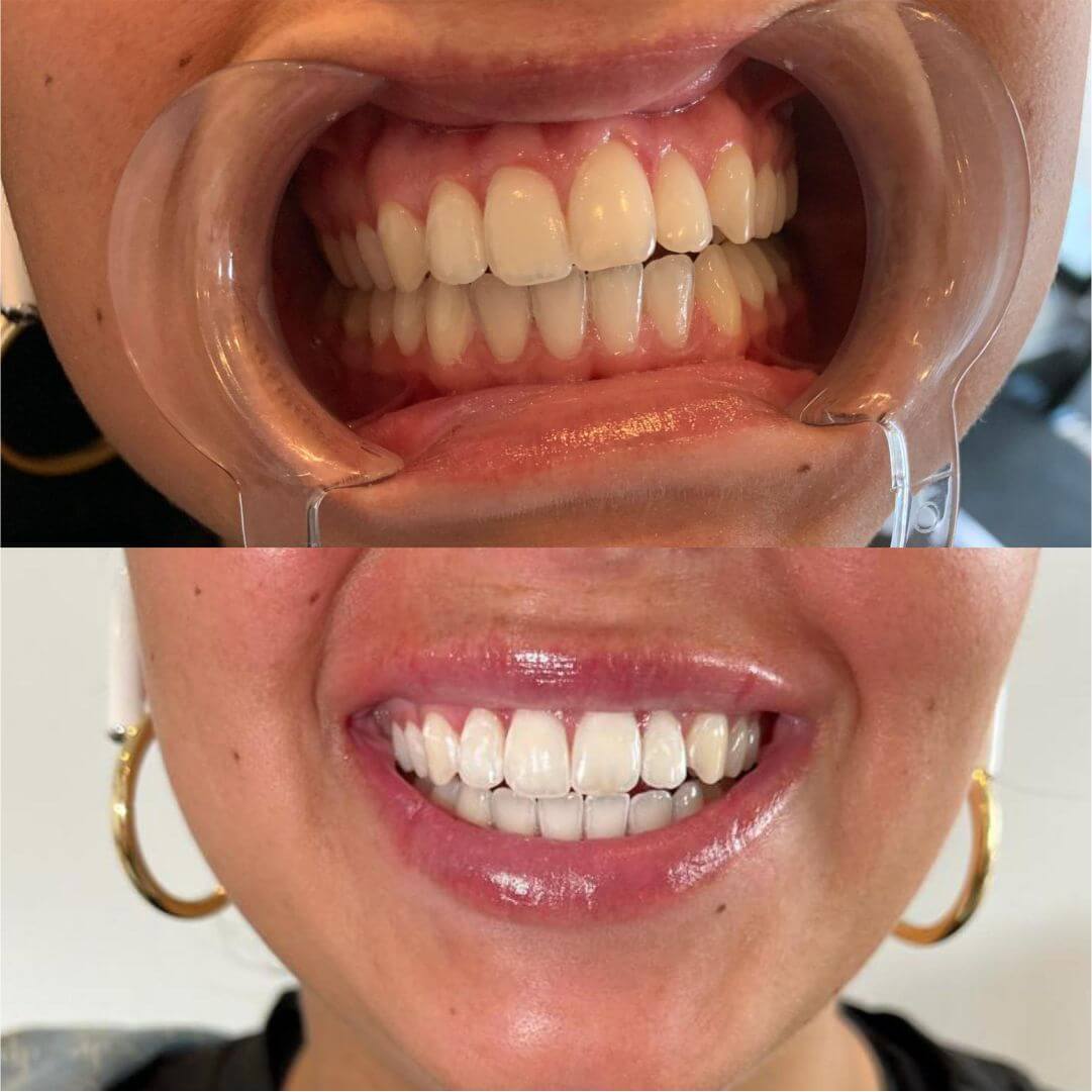diamond-smile diamond-smile